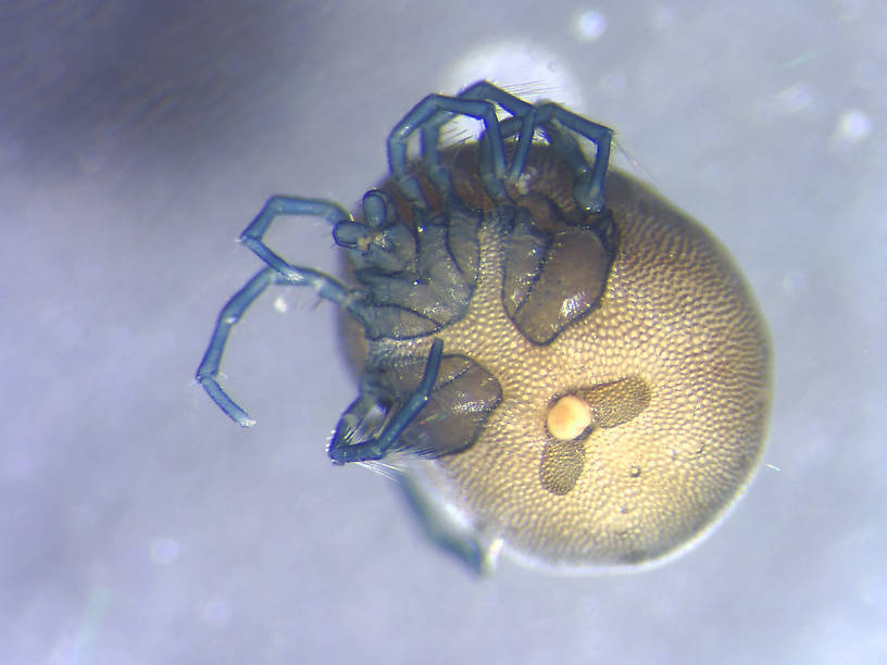 Arachnida (Mites and Spiders) Arthropod Adult from Various wetlands in Montana