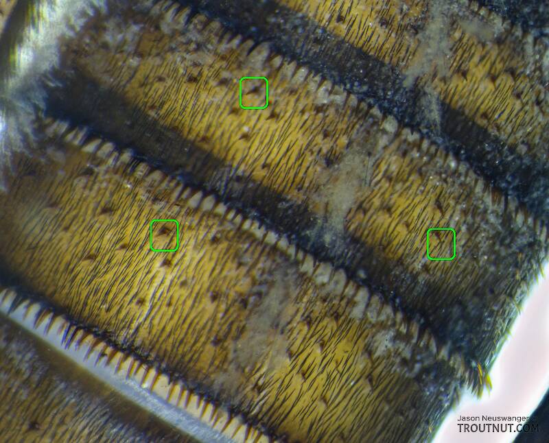 A few examples of the numerous intercalary bristles in this image are boxed in green.